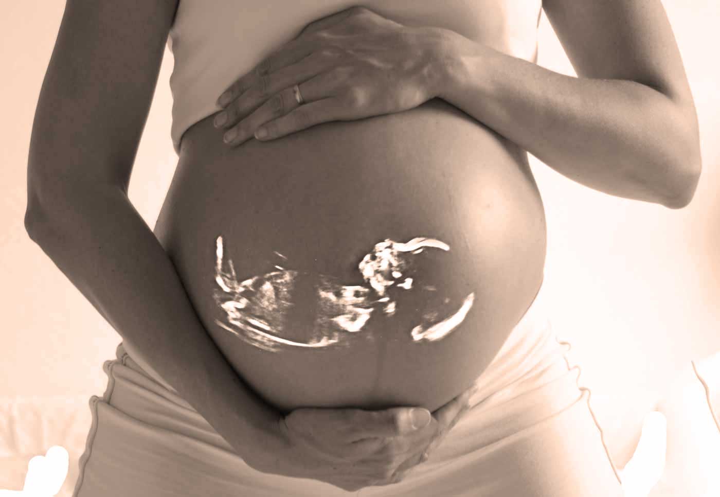 Schwangere Frau beim Ultraschall
